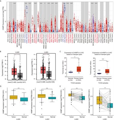 Hepcidin Upregulation in Lung Cancer: A Potential Therapeutic Target Associated With Immune Infiltration